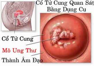co tu cung